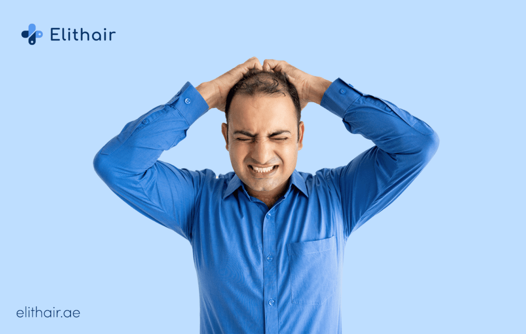 تساقط الشعر - مشفى اليت هير لزراعة الشعر