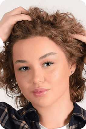 بعد زراعة الحواجب في تركيا