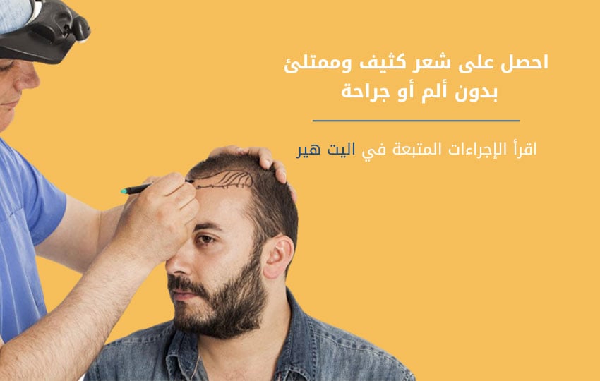 زرع الشعر بدون جراحة بمركز اليت هير | افضل مركز زراعة شعر