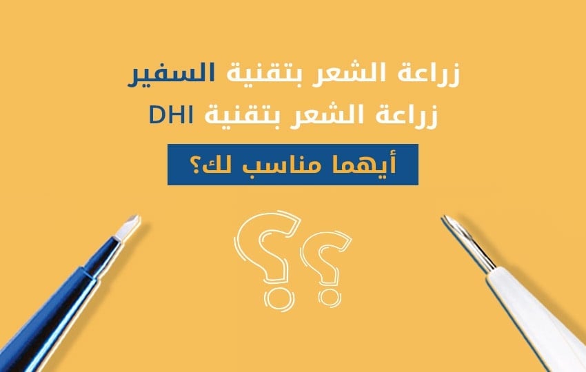 الفرق بين زراعة الشعر بتقنية السفير و زراعة الشعر بتقنية DHI