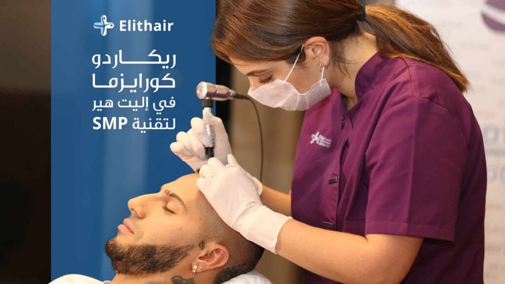 تقنية SMP لريكاردو كواريزما - مركز اليت هير لزراعة الشعر