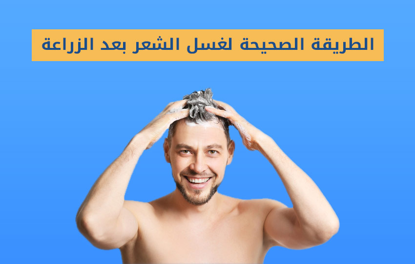 تعرف على الطريقة الصحيحة لغسل الشعر بعد الزراعة من مركز اليت هير