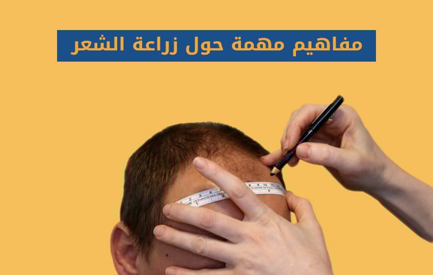 احدث طرق زراعة الشعر بمركز اليت هير