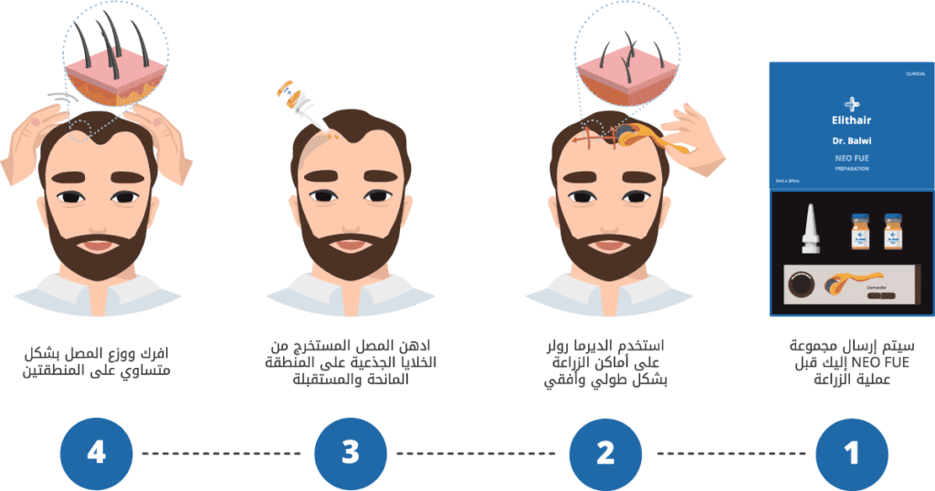 خطوات استخدام مجموعة NEO FUE التحضيرية الحصرية بمركز إليت هير 1024x538 min