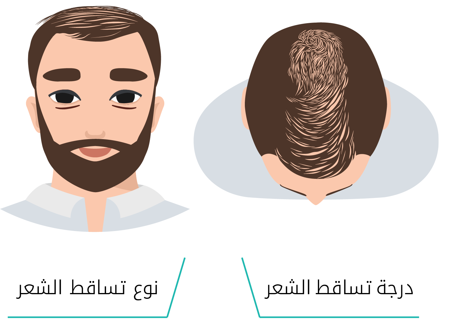 انفوجرافيك يوضح أنواع تساقط الشعر إليت هير لزراعة الشعر