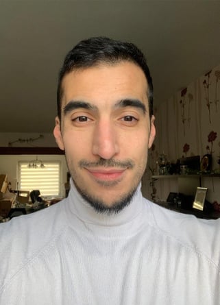 السيد عصام لعملية زراعة الشعر بمركز اليت هير بعد 9 أشهر