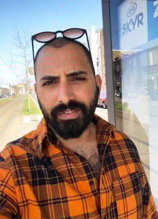 السيد مجد بعد عملية زراعة الشعر في إليت هير بشهر واحد