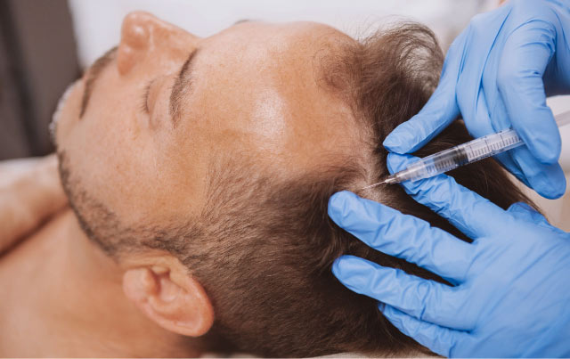 دراسة البلازما PRP | أكبر مركز زراعة شعر اليت هير