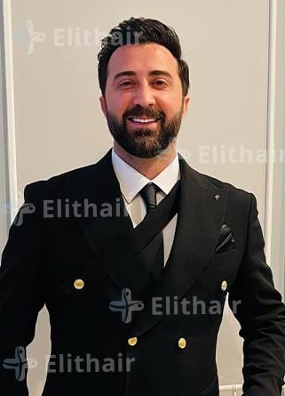 الفنان عبد الكريم حمدان نتائج-زراعة-الشعر-في-مركز-اليت-هير