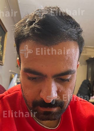 السيد أحمد بعد 4 شهور في مركز اليت هير