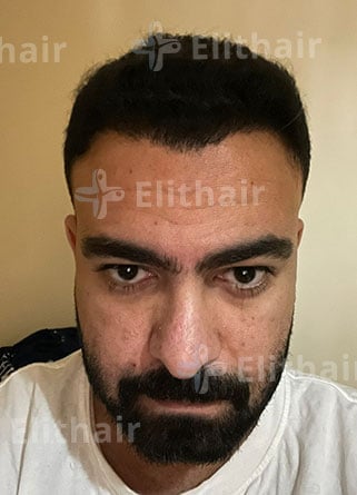 السيد أحمد بعد 6 شهور في مركز اليت هير