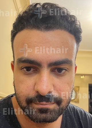 السيد أحمد بعد 8 شهور في مركز اليت هير