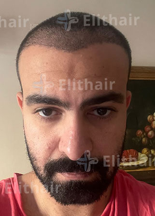 السيد أحمد بعد شهر في مركز اليت هير