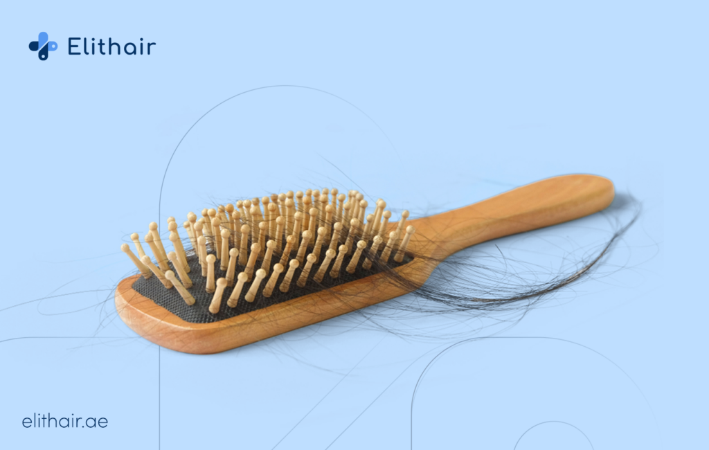 تساقط الشعر عند الرجال - مشفى اليت هير لزرعة الشعر