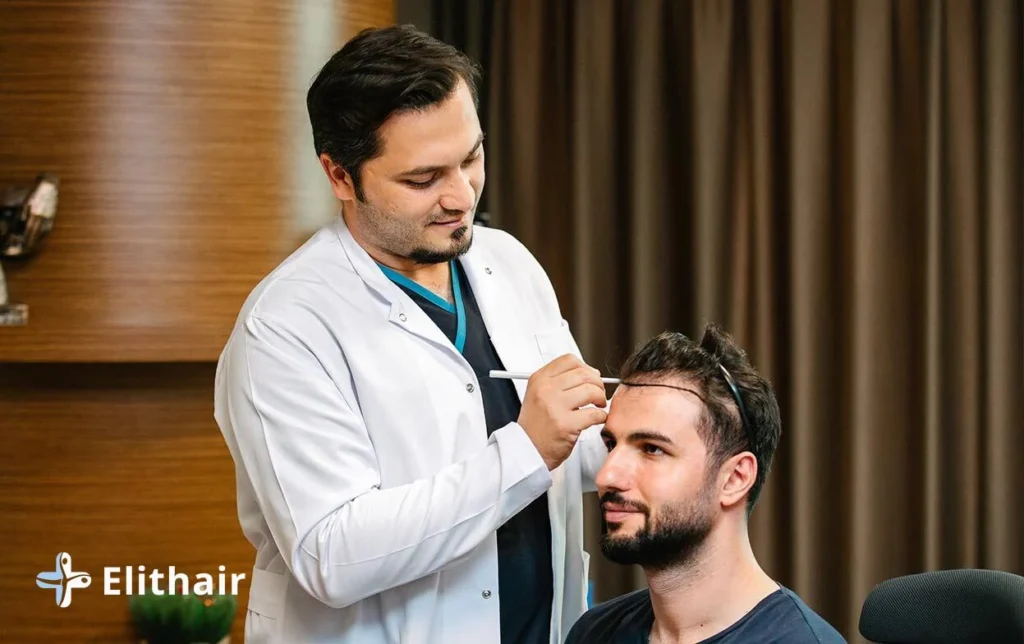 تجارب زراعة الشعر في تركيا