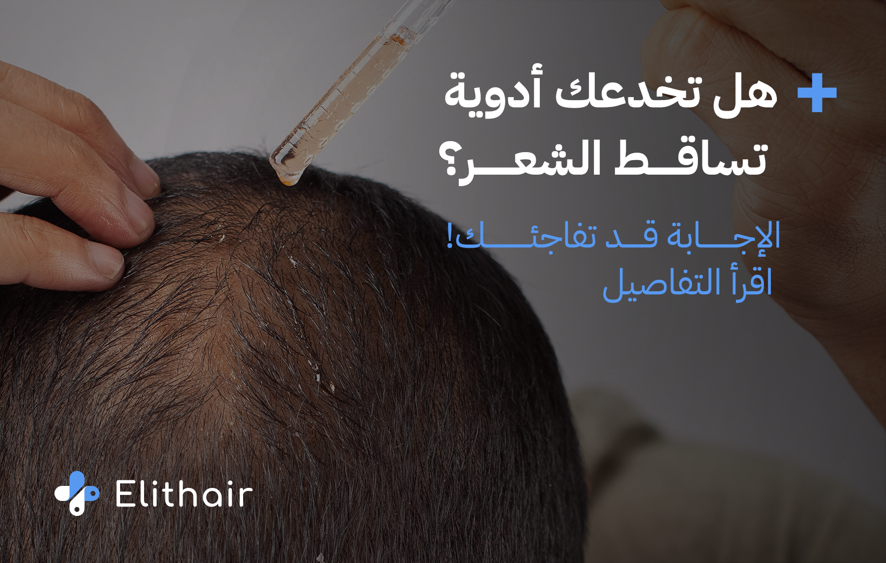 هل تقدم الأدوية طريقة فعالة لعلاج تساقط الشعر