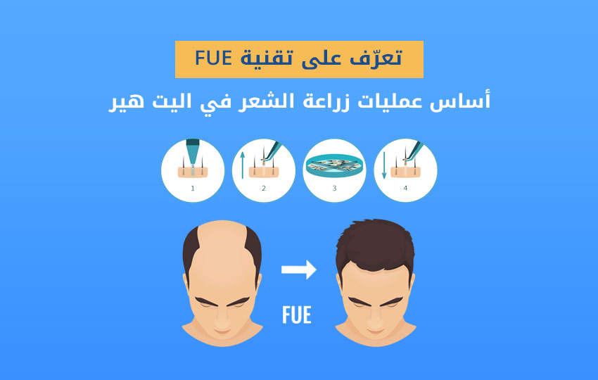 زراعة-الشعر-بتقنية-الاقتطاف-مركز-اليت-هير-لزراعة-الشعر