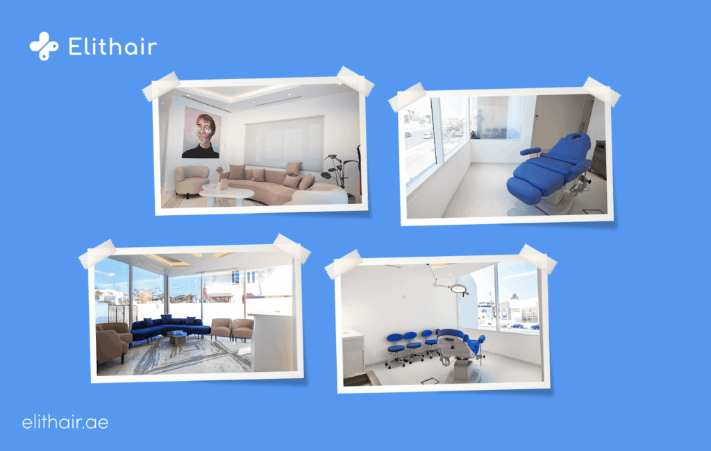 كيفية اختيار أفضل مركز زراعة شعر