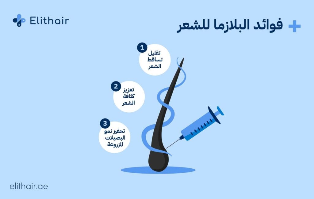 حقن البلازما الغنية بالصفائح الدموية - مشفى اليت هير لزراعة الشعر