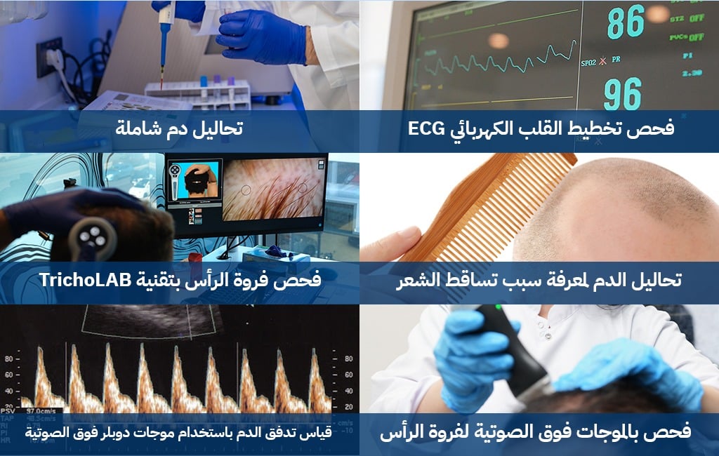 التحاليل الطبية الشاملة ماقبل زراعة الشعر في اليت هير