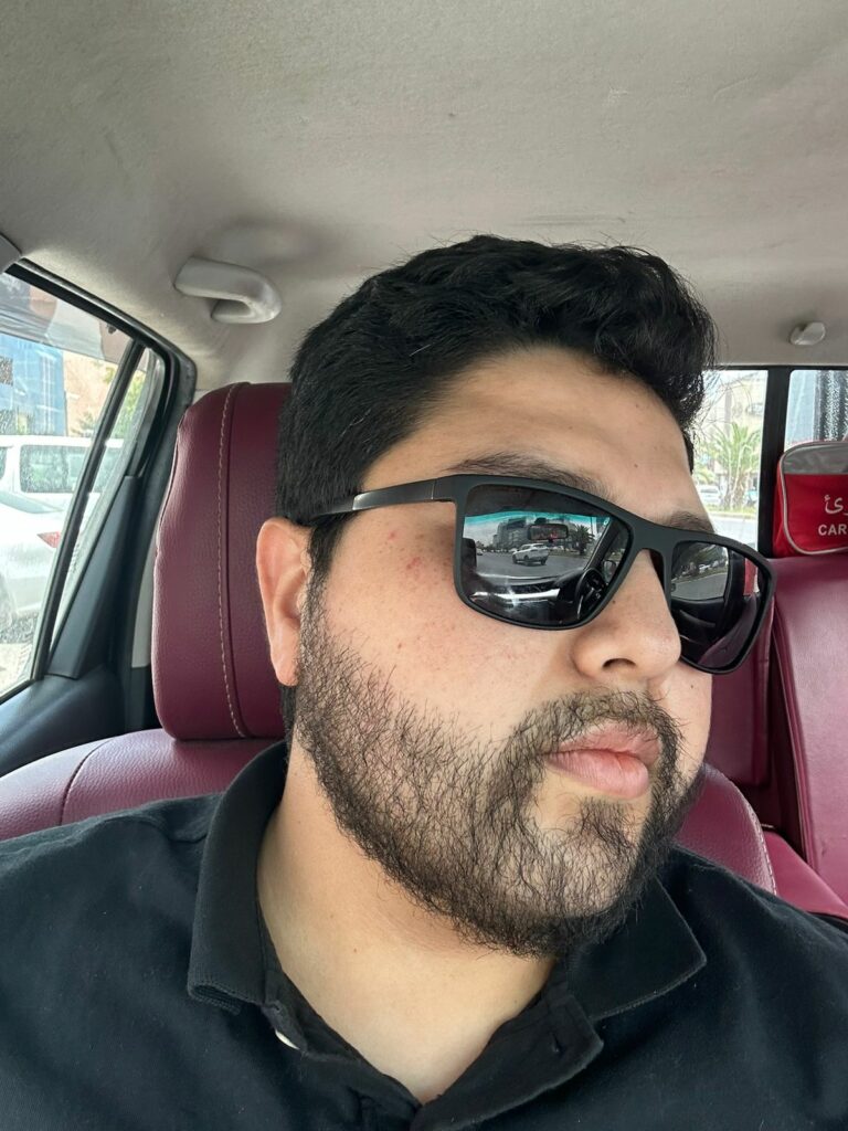 بعد 9 أشهر من زراعة اللحية - مركز اليت هير لزراعة الشعر