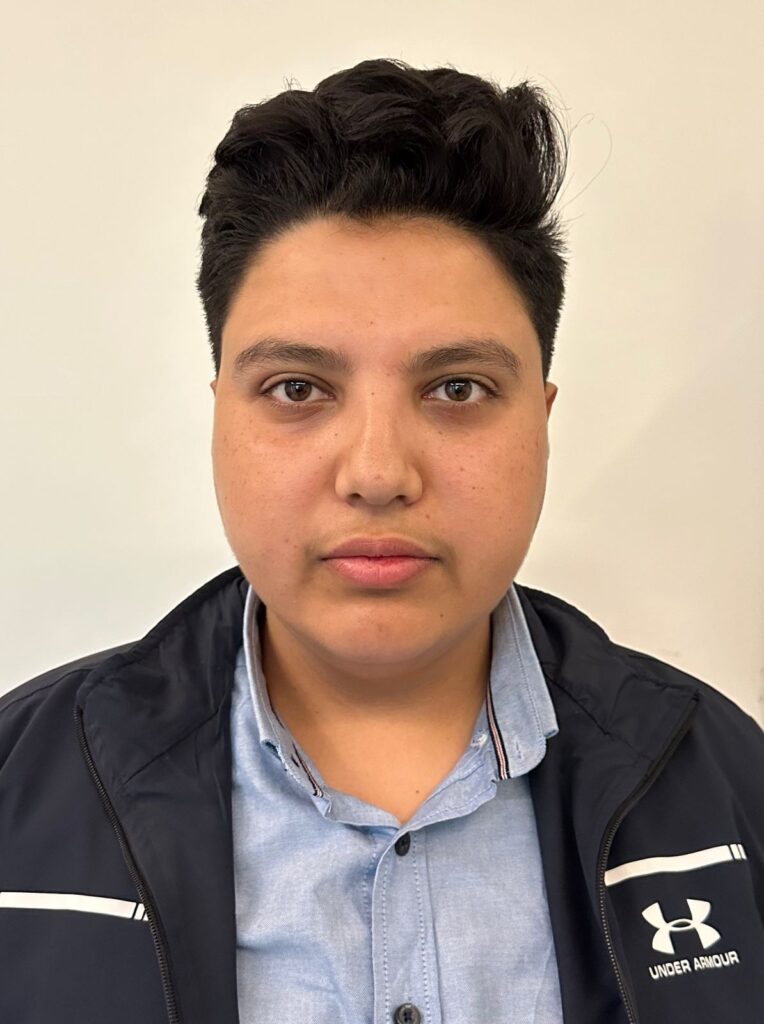 قبل زراعة اللحية - مركز اليت هير