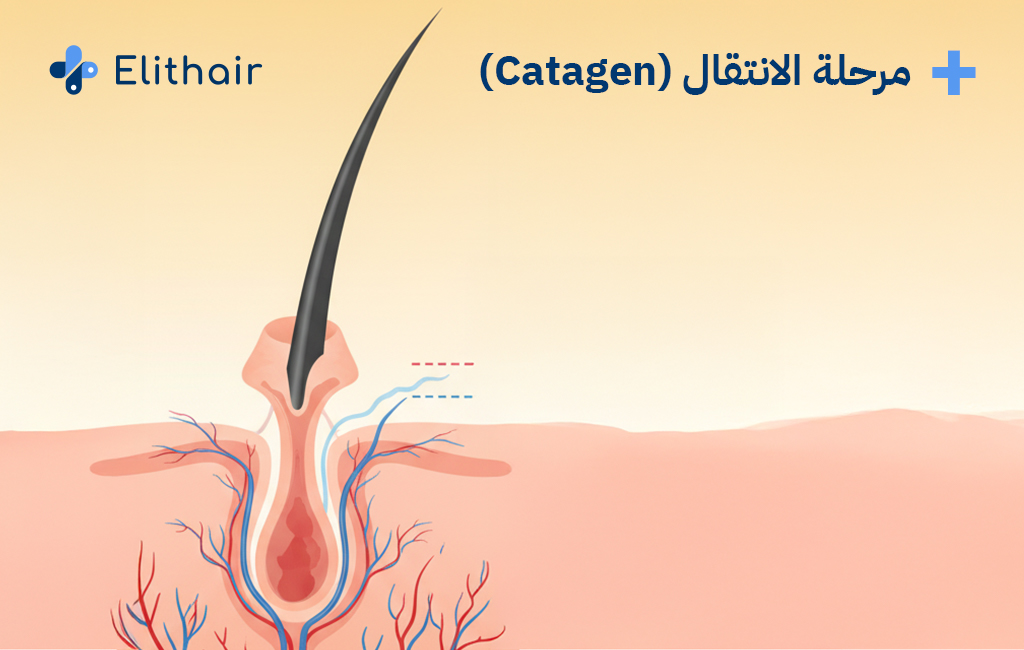 مرحلة الانتقال من مراحل نمو الشعر