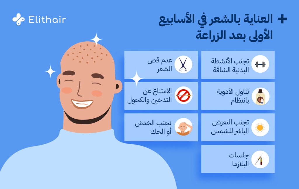 العناية بالشعر في الأسابيع الأولى بعد الزراعة - مشفى اليت هير لزراعة الشعر