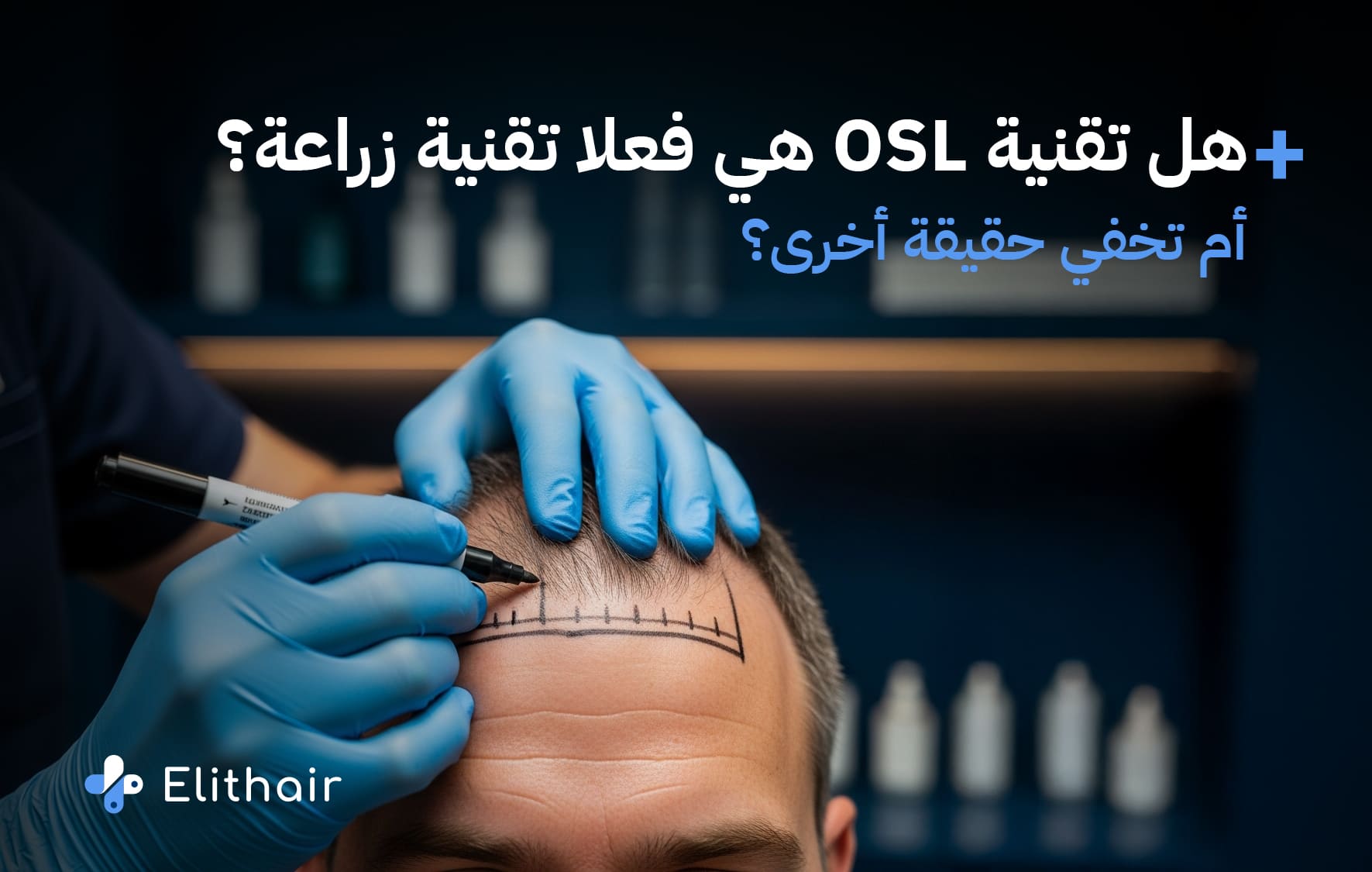ما هي تقنية OSL وكيف تعمل؟