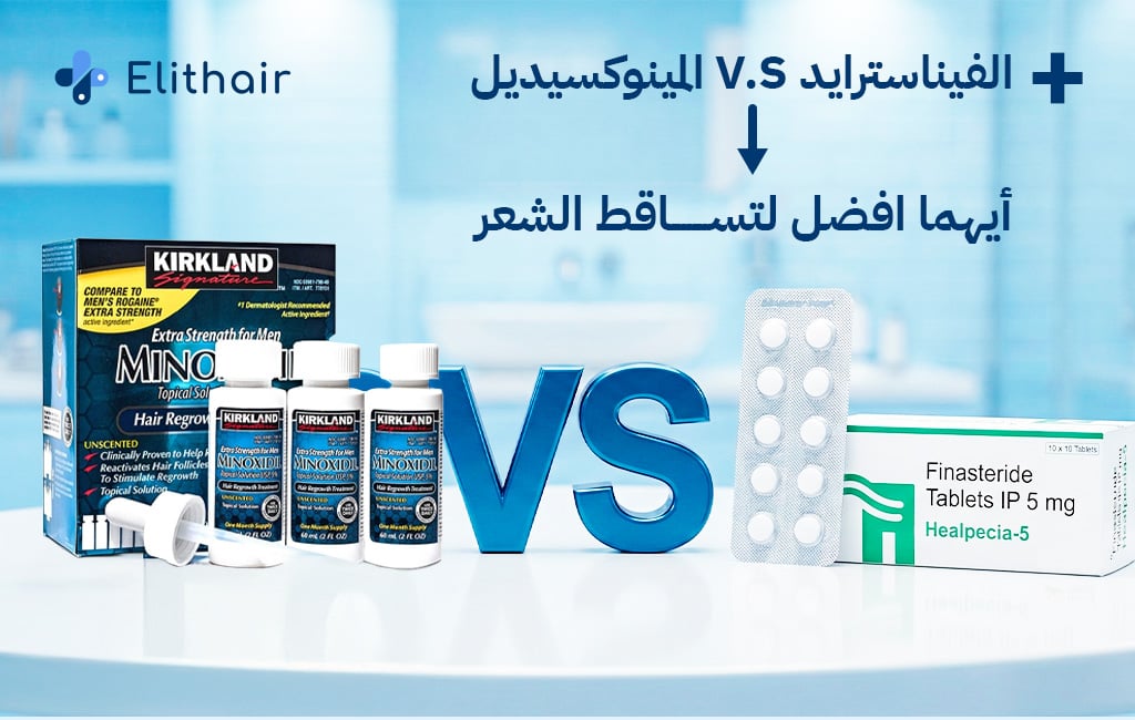 المينوكسيديل أم الفيناسترايد. أيهما أفضل - مركز اليت هير لزراعة الشعر