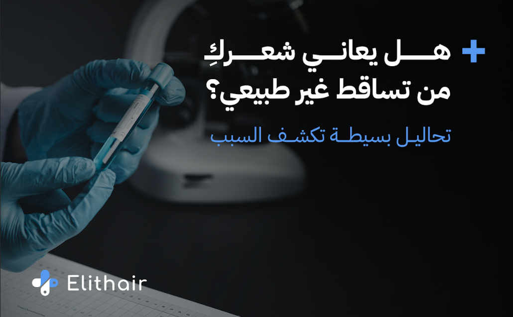 التحاليل المطلوبة لمعرفة تساقط الشعر للنساء