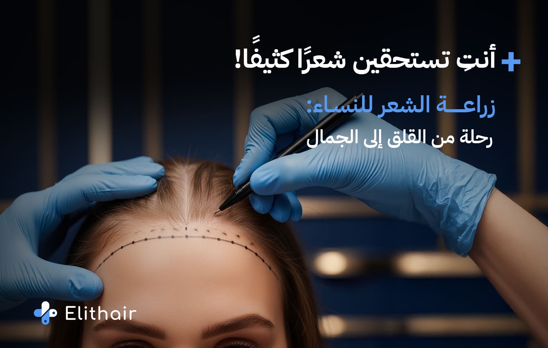 تقنيات زراعة الشعر للنساء في تركيا في اليت هير