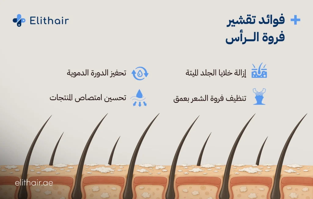 أسباب اتساخ فروة الرأس - مركز اليت هير لزراعة الشعر