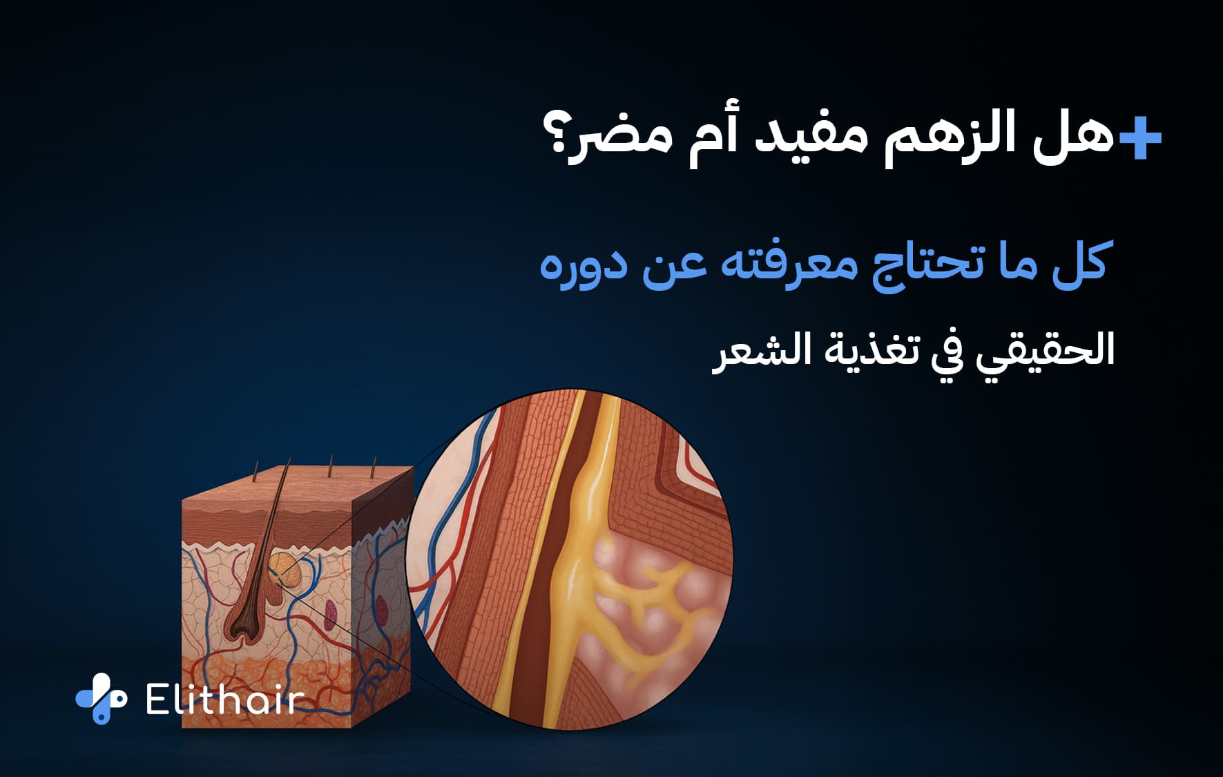 تعرف على الزهم وفوائده من مركز اليت هير لزراعة الشعر