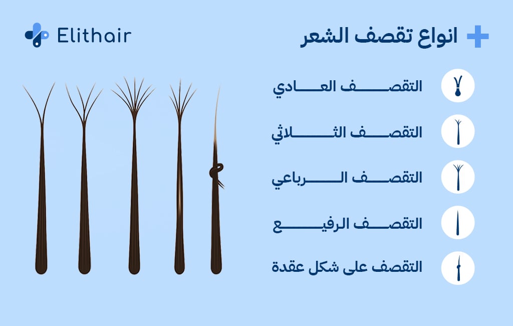 أنواع تقصف الشعر - مركز اليت هير لزراعة الشعر