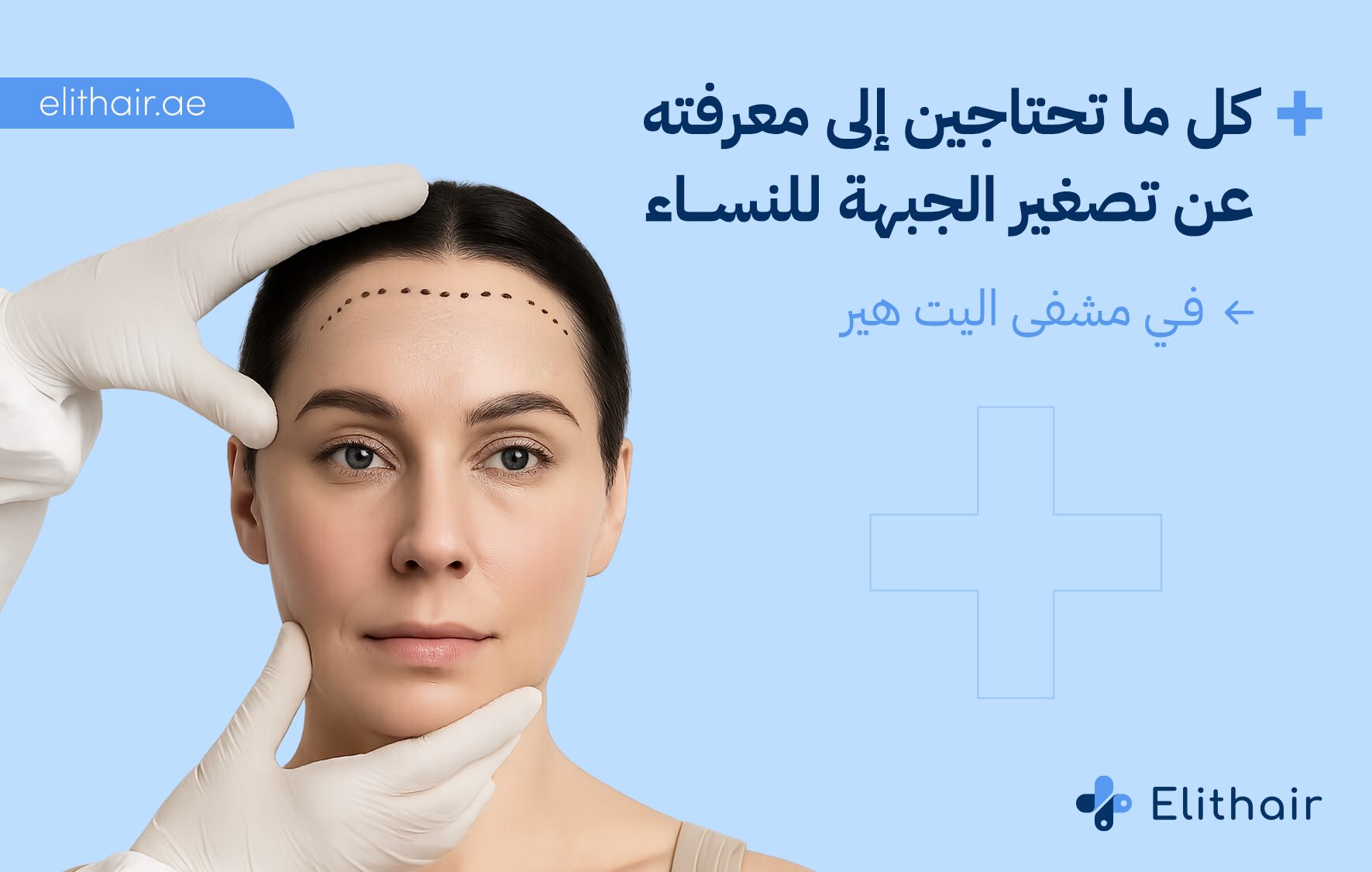 تصغير الجبهه للنساء في مركز اليت هير لزراعة الشعر