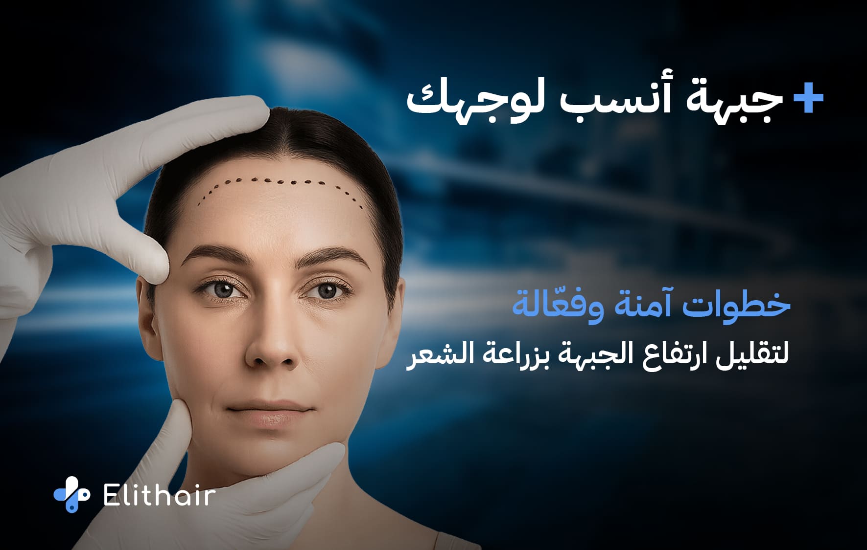 تصغير الجبهه للنساء في مركز اليت هير لزراعة الشعر