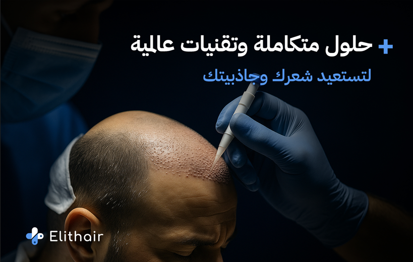 تقنيات زراعة الشعر - مركز اليت هير لزراعة الشعر