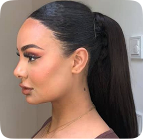 زراعة الشعر للنساء
زراعة الشعر للنساء