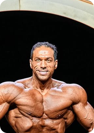 قبل وبعد زراعة الشعر في تركيا