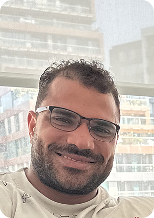 قبل وبعد زراعة الشعر في تركيا