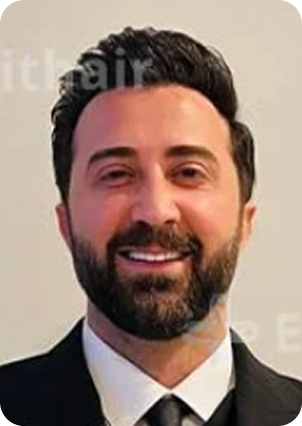 قبل وبعد زراعة الشعر في تركيا
