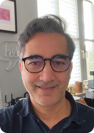 قبل وبعد زراعة الشعر في تركيا