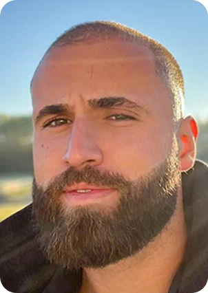 قبل وبعد زراعة اللحية في تركيا