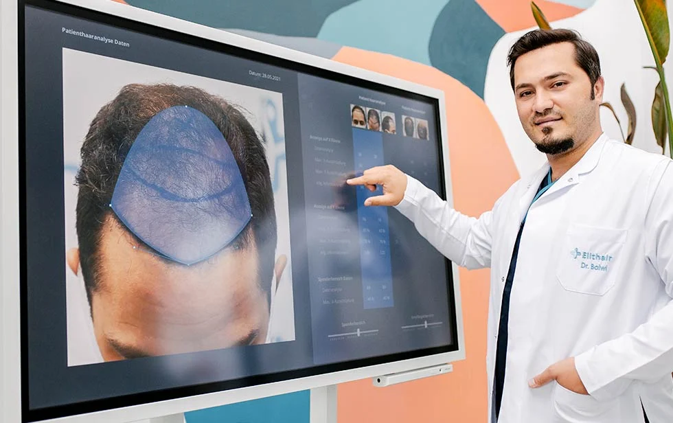 الفحوصات الطبية قبل زراعة الشعر فحص فروة الرأس بتقنية TrichoLAB – تحليل دقيق لنوعية الشعر