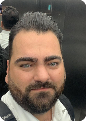 قبل وبعد زراعة الشعر في تركيا