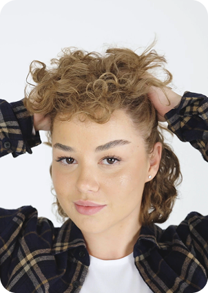 قبل وبعد زراعة الشعر للنساء في تركيا