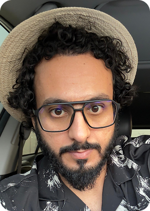 السيد إبراهيم بعد زراعة الشعر في تركيا