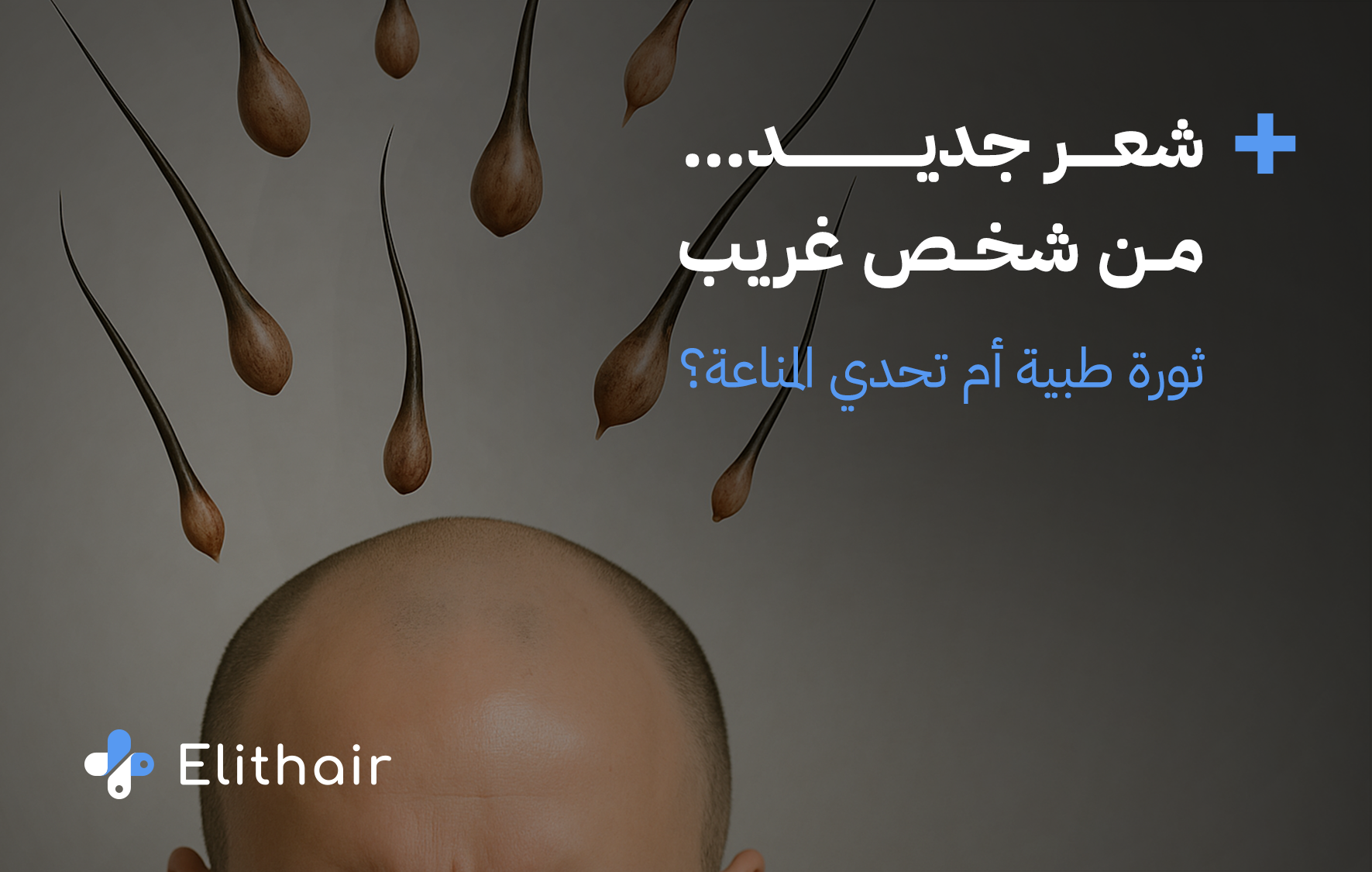 زراعة الشعر من شخص آخر - مركز اليت هير لزراعة الشعر
