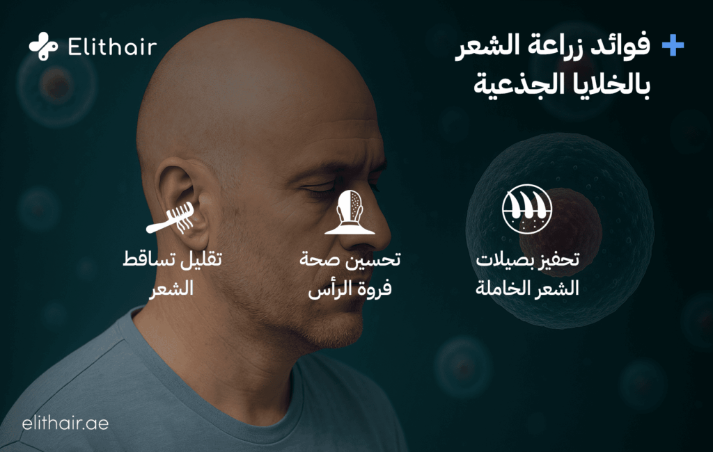 فوائد الخلايا الجذعية - مركز اليت هير لزراعة الشعر